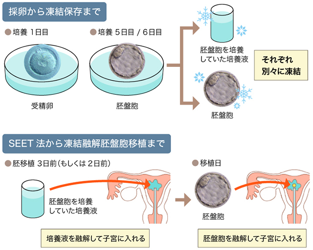 子宮 内 膜 掻爬 を すると